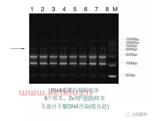 凝胶电泳的分类及价格,琼脂糖凝胶电泳的原理琼脂糖凝胶电泳的原理介绍